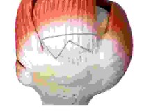 Smith+Nephew completes acquisition of Integrity Orthopaedics; establishes unrivalled portfolio for shoulder repair