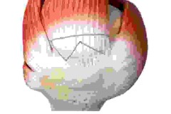 Smith+Nephew to feature leading rotator cuff repair portfolio including new Tendon Seam™ Repair System and REGENETEN◊ Bioinductive Implant at AAOS 2026