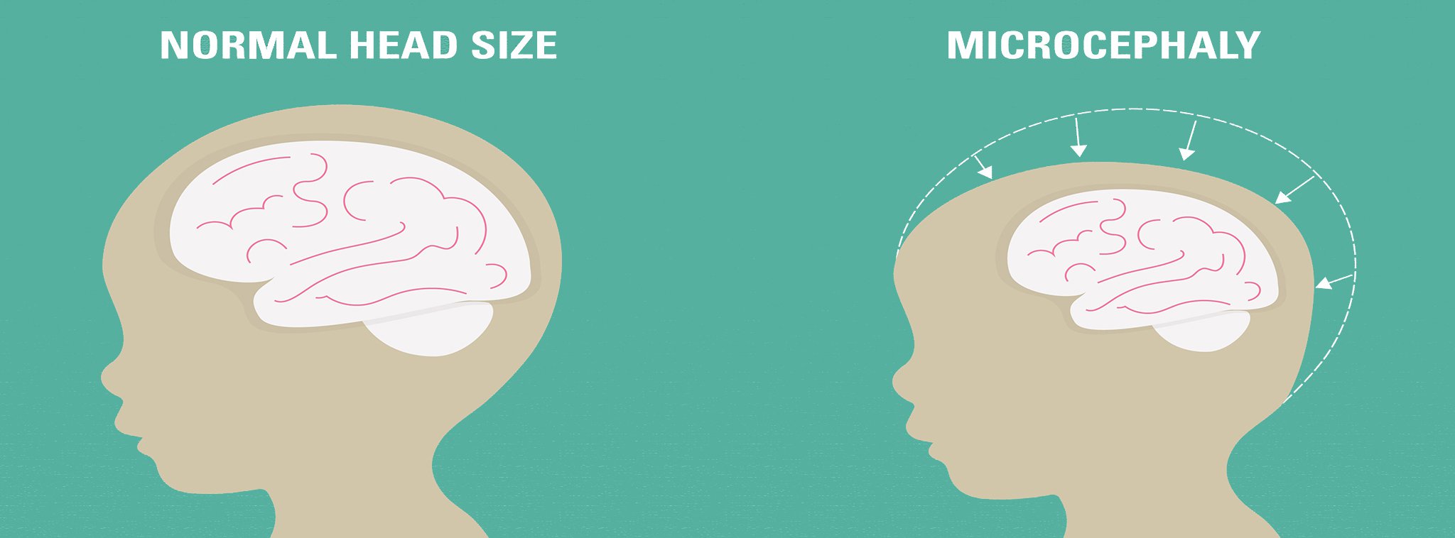 Não nhân tạo - một bước tiến mới trong nghiên cứu virus Zika